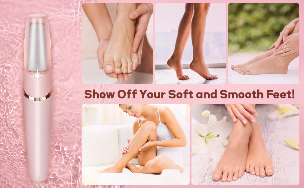 SoleGlow™ – Electronic Cordless Pedicure & Callus Deadskin Remover ✨🦶